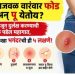 गुदद्वाराजवळ वारंवार फोड अन् पू येतोय? दुर्लक्ष करण्याची चूक पडेल महागात, वेळीच ओळखा भयंकर आजाराची ही ५ लक्षणे!